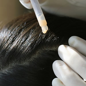 Hair treatments